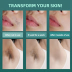 IPL Hair Removal Device detail view 10 for Australian shoppers
