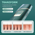 IPL Hair Removal Device detail view 12 for Australian shoppers